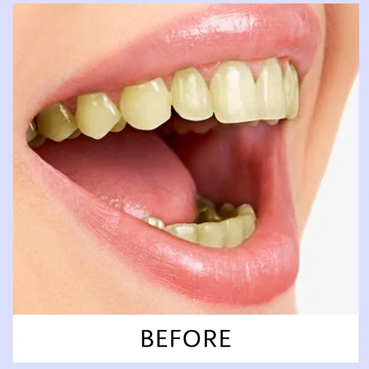 Purple Teeth Whitening Strips Improve Dental Yellowing Oral Cleaning Gel Teeth Bright Stain for Lasting Bright Smile